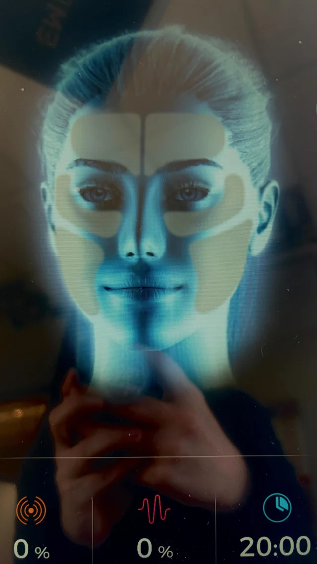 🚨 NEW TREATMENT ALERT: EMFACE for TMJ! 🚨

We’re officially the FIRST clinic in Omaha to offer the revolutionary Emface® TMJ protocol — and it’s changing the game. 💥

✨ What it does:
✔️ Relaxes facial tension + tight jaw muscles
✔️ Lifts + tones the lower face
✔️ Improves symmetry and facial harmony
✔️ Zero needles, zero downtime 🙌

If you’ve ever struggled with TMJ, clenching, or tension headaches — this is your sign. 💆‍♀️💆‍♂️
Experience muscle relaxation and skin tightening in one powerful treatment.

Omaha, the future of facial wellness is HERE. 💫

#Emface #EmfaceTMJ #OmahaMedSpa #MedSpaTechnology #FacialWellness #TMJRelief #JawTension #AestheticsClinic #SkinTightening #NonInvasiveTreatment #MedSpaOmaha #FaceLifting #EmfaceExperts #ConfidenceLooksGoodOnYou