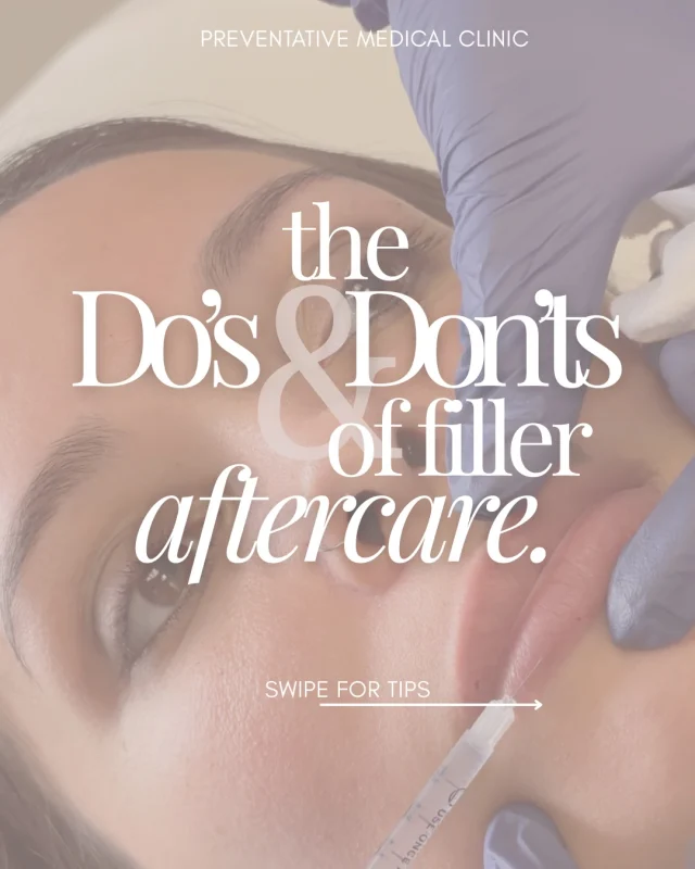 💉You just got filler… now don’t ruin it. 👀

Aftercare is what takes your results from good → flawless.

A few simple do’s and don’ts can make all the difference in how your filler settles, heals, and lasts.

Think:
✨ less swelling
✨ better results
✨ longer-lasting outcome

Your injector did their part — now it’s yours. 😉

Save this so you don’t forget after your next appointment.

📍 Omaha, NE
@pmcomaha 

#FillerAftercare #DermalFiller #OmahaMedSpa #PMCOmaha #Injectables AestheticReels MedicalAesthetics LipFiller GlowUpOmaha MedSpaTips AftercareMatters