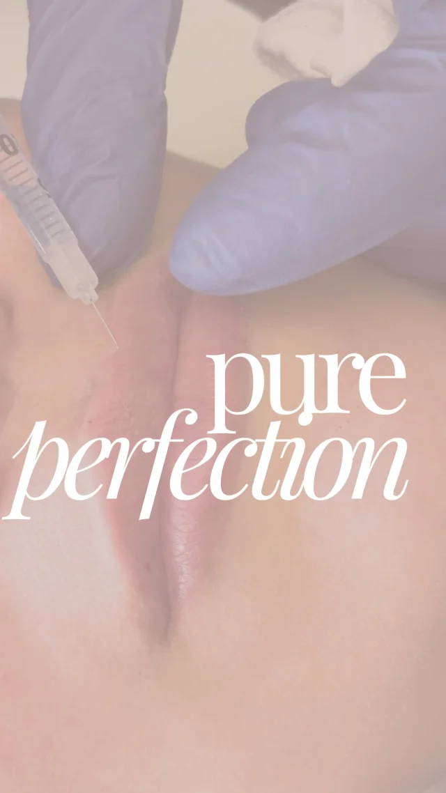 Whenever a client says this, we know we’re about to enter a long-term relationship. 🤝

The truth about “Natural” Filler:
It’s not about changing your face; it’s about restoring what the years (and stress) took away. It’s the difference between “Did you get work done?” and “Did you just get 10 hours of sleep?” 😴✨

There’s a fine line between “enhanced” and “obvious,” and we live for that sweet spot in the middle. Whether it’s your first time or your tenth, we’re here to make sure the only person who knows your secret is your injector. 🤫
Ready for your glow-up?

#LipFiller #OmahaAesthetics #FillerHumor #NaturalInjectables MedSpaLife LipFlip BeautyStandard OmahaMedSpa AestheticNurse LipGoals GlowUp