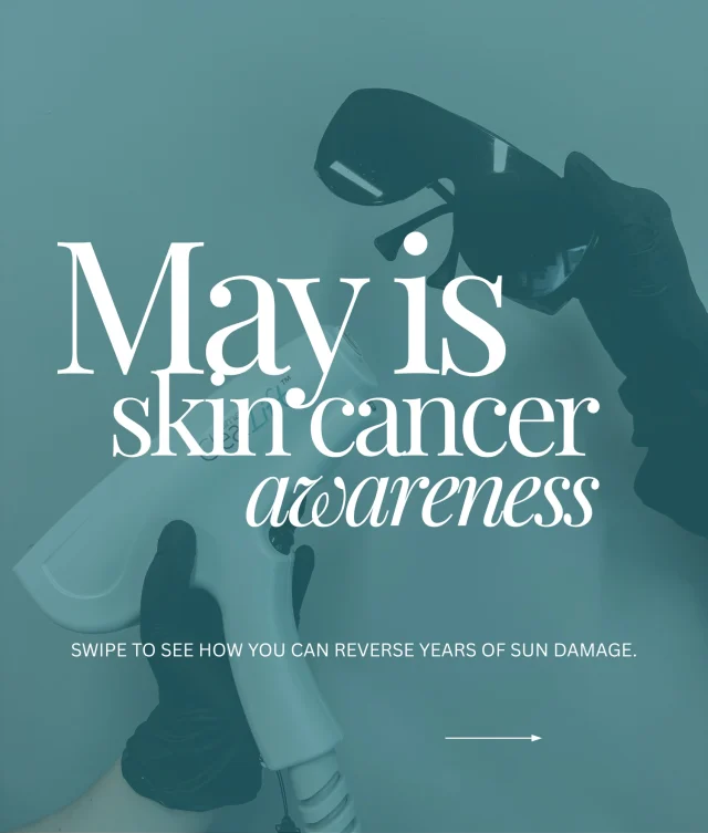 Your skin has been keeping score. ☀️

Every skipped SPF. every beach day without reapplying. every “I’ll start being more careful next summer.”

It adds up. and eventually — it shows up.

The good news? reversal is real. and it starts with knowing exactly what your skin actually needs.

Is sunscreen part of your daily routine? Swipe through → we broke it down step by step

📍Omaha, Ne