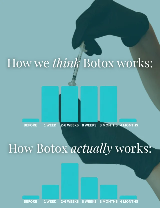 💉 HOW PEOPLE THINK BOTOX WORKS:

❌ “It freezes your entire face.”
❌ “You’ll look surprised forever.”
❌ “Nobody will know how to make facial expressions.”

Reality? 👇

✨ Botox doesn’t erase your personality.
✨ It relaxes specific muscles that create wrinkles.
✨ You can still smile, laugh, frown, and show emotion—you just won’t be recruiting every forehead muscle within a 10-mile radius. 😅

Think of Botox less like “freezing” and more like turning the volume down on wrinkle-causing muscle movements.

The result?
✔️ Softer lines
✔️ Smoother skin
✔️ A refreshed look that has people saying, “You look amazing!” instead of “Did you get Botox?”

And the best part? Preventing wrinkles is a whole lot easier than correcting deep ones later. 👏

Tell us below👇

What was the BIGGEST Botox myth you believed before learning how it actually works?

🎉 Ask us about our Botox Membership for exclusive savings all year long.
🔥 Don’t forget about our Botox Day specials and limited-time deals!

#BotoxMyths #BotoxFacts #BotoxBeforeAndAfter #PreventativeBotox #MedicalAesthetics
