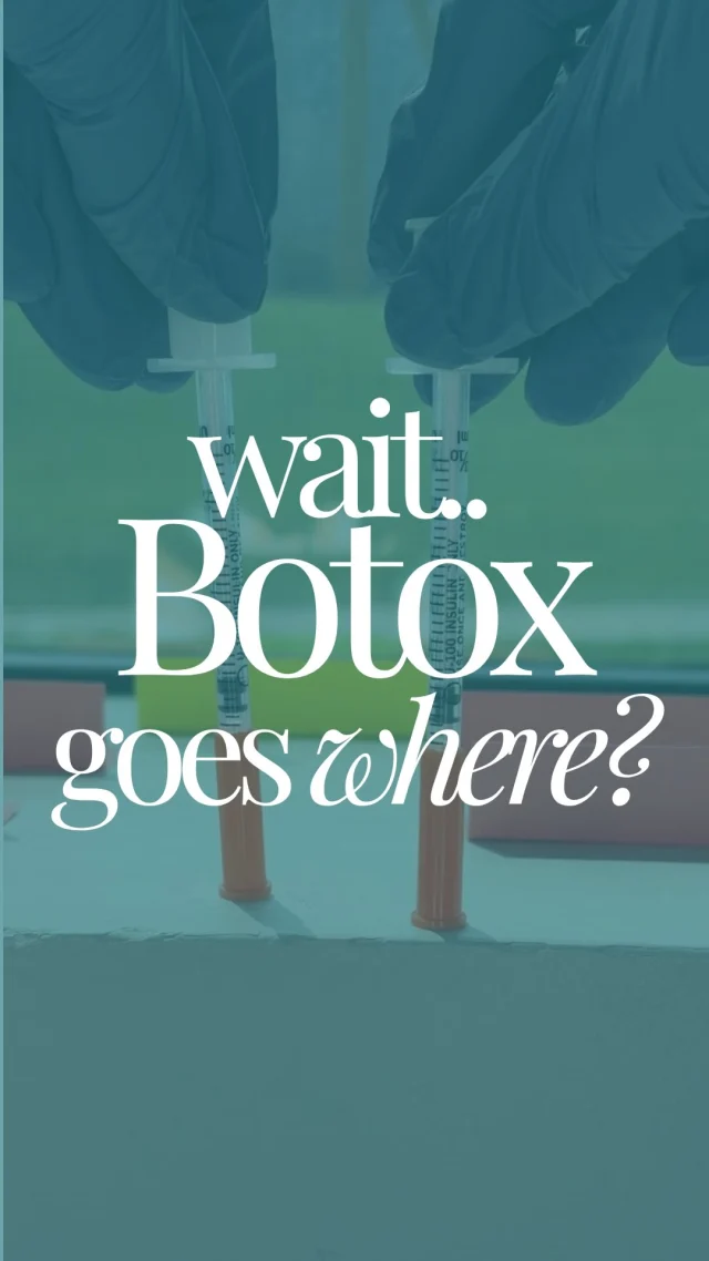 Wait… Botox goes THERE too?! 👀

Think Botox is only for forehead lines? Think again.

✨ Forehead lines
✨ Frown lines (“11’s”)
✨ Crow’s feet
✨ Lip flip
✨ Neck bands
✨ Excessive sweating

Botox is one of the most versatile treatments we offer—and chances are, there’s a treatment area on this list you didn’t know about!

💉 Want the best value on your Botox?
Ask us about our Botox Membership for exclusive savings year-round, plus don’t forget about our Botox Day specials for even bigger deals on your favorite treatment.

👇 Which area surprised you the most? Let us know in the comments!

MedicalAesthetics #AestheticInjector #WrinkleRelaxer #NaturalResults #MedSpa #SelfCare ConfidenceBoost GlowUp